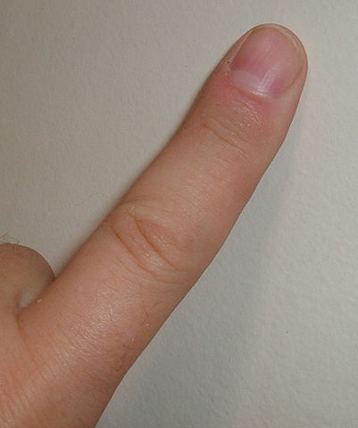 401px-Finger.agr.jpg